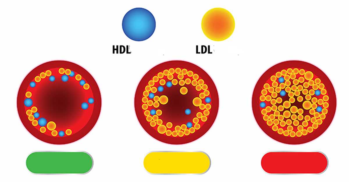 ldl-holesterol-6
