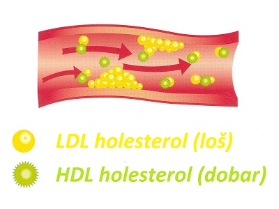 ldl-holesterol-2